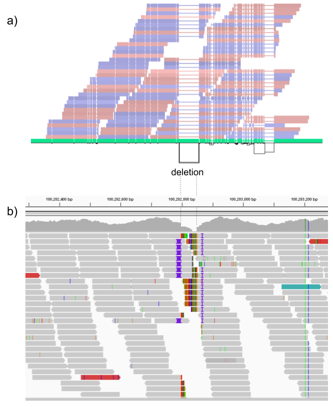 Figure 3: Exonic deletion in the HGSVC dataset correctly genotyped by vg. a) Visualization of the HGSVC graph as augmented by reads aligned by vg at a locus harboring a 51 bp homozygous deletion in the UTR region of the LONRF2 gene. At the bottom, a horizontal black line represents the topologically sorted nodes of the graph. Black rectangles represent edges found in the graph. Above this rendering of the topology, the reference path from GRCh38 is shown (in green). Red and blue bars represent reads mapped to the graph. Thin lines in the reference path and read mappings highlight relative gaps (either insertions or deletions) against the full graph. The vg read mappings show consistent coverage even over the deletion. b) Reads mapped to the linear genome reference GRCh38 using bwa in the same region. Reads contain soft-clipped sequences and short insertions near the deletion breakpoints. Part of the deleted region is also covered by several reads, potentially confusing traditional SV genotypers.